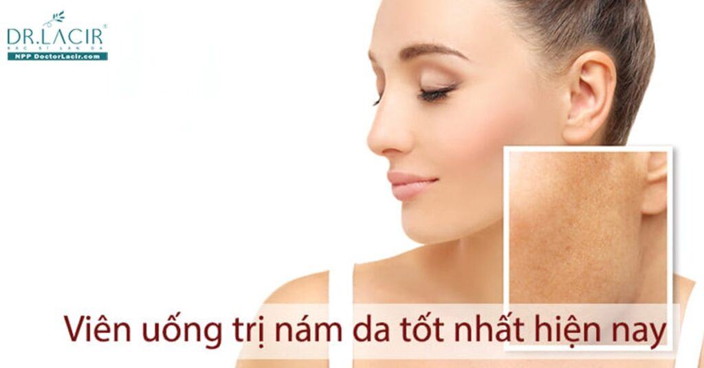 Top 5 viên uống nám tốt nhất hiện nay