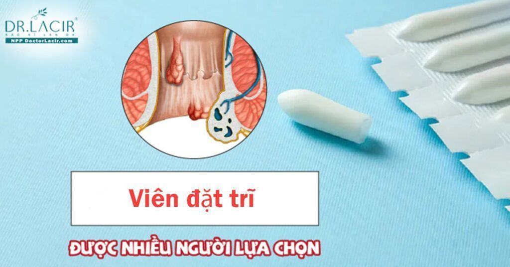 Tìm hiểu về Viên đặt trĩ Trần Kim Huyền