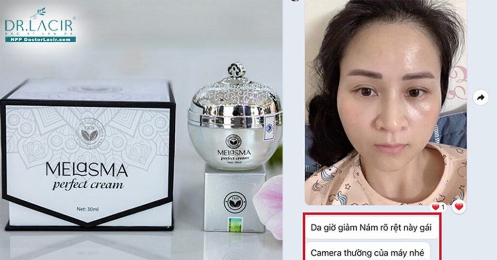 Kết quả sau 3 tháng sử dụng vua nám Trần Kim Huyền