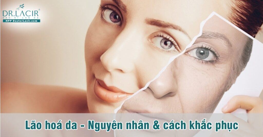 Lão hóa da - Nguyên nhân và cách khắc phục hiệu quả