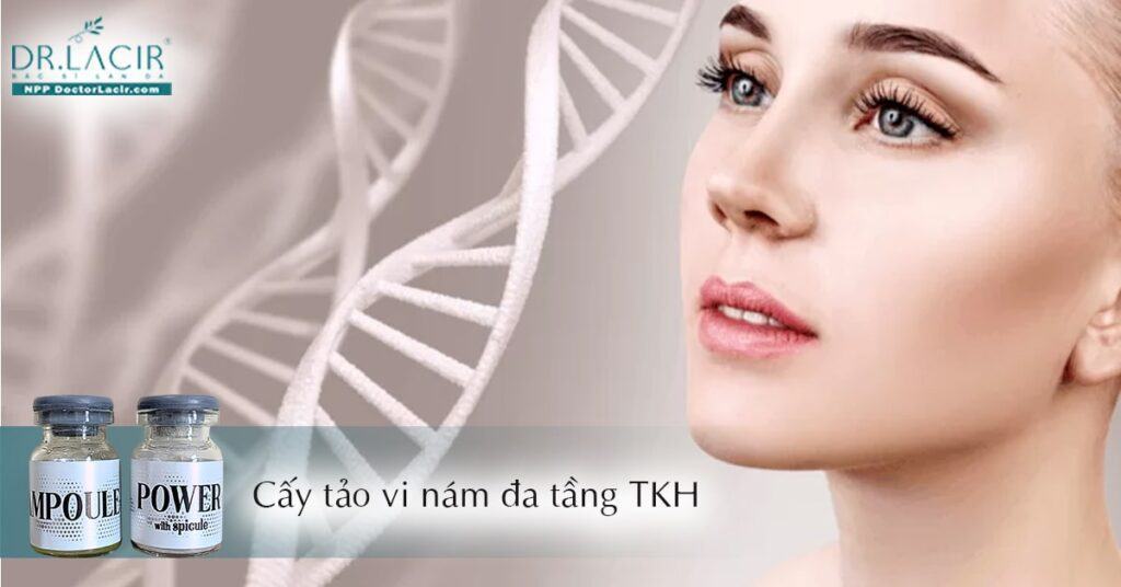 5 lý do nên sử dụng cấy tảo vi nám Trần Kim Huyền